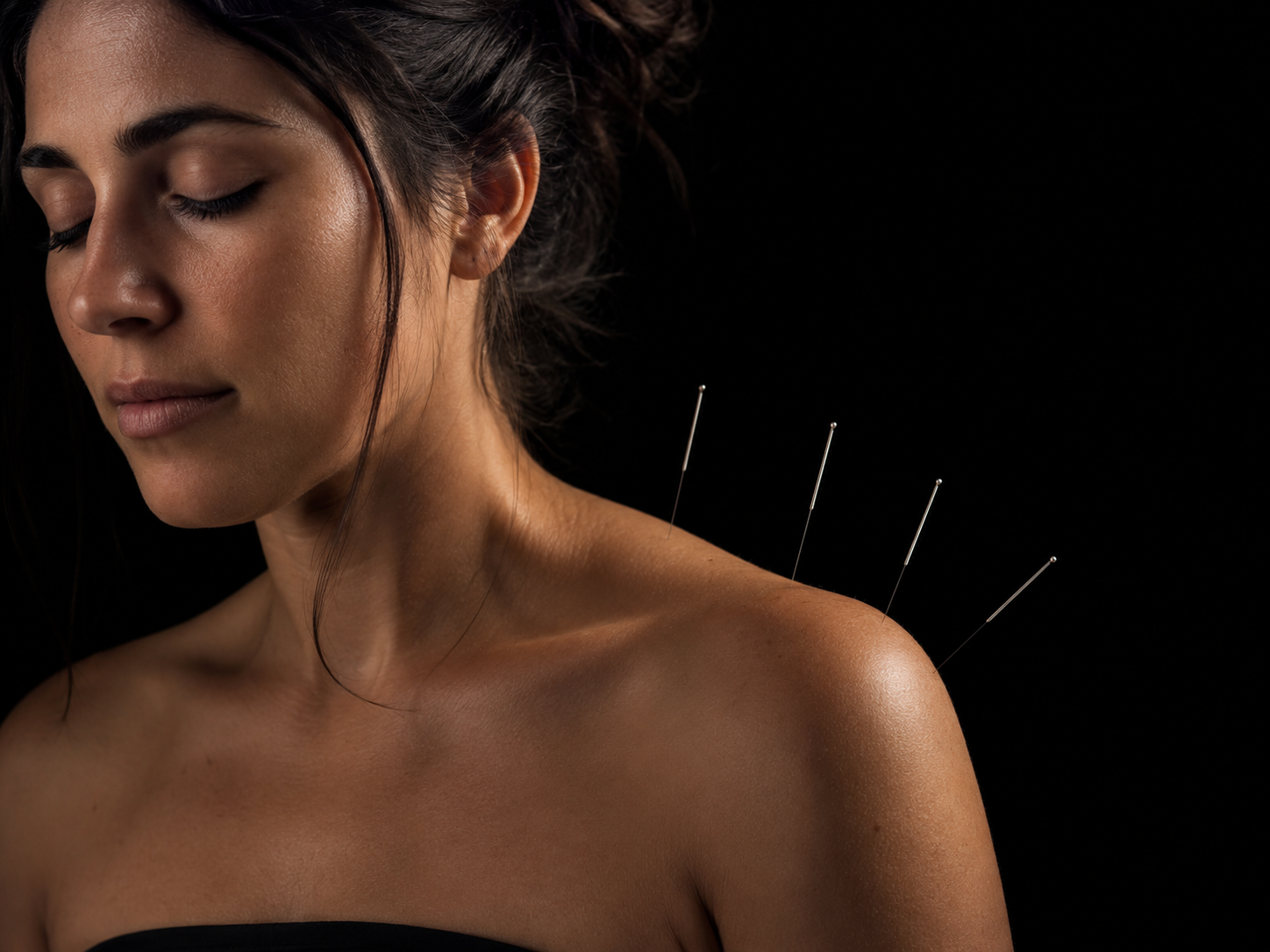 acupuncture near me